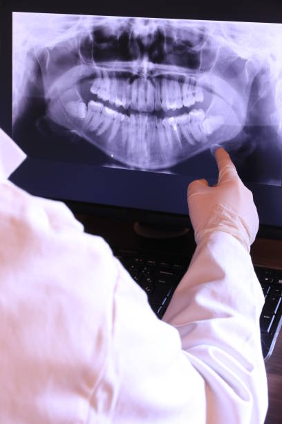 Best Emergency Tooth Extraction in Blythewood, SC